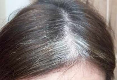 How do you prevent gray hair?